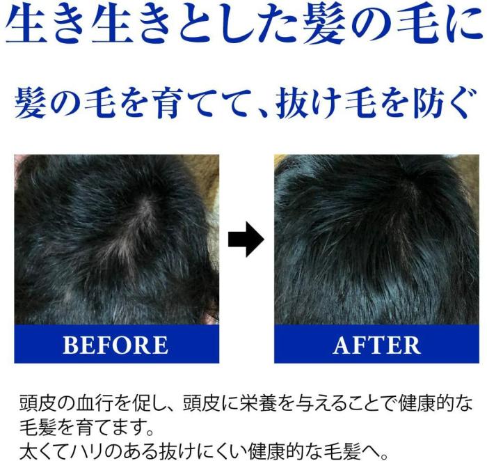 h-155102 メイコー化粧品 薬用ヘアーエッセンスW 発毛促進剤 男女兼用 150ml 医薬部外品 日本製 商品画像4：セイカオンラインショップ